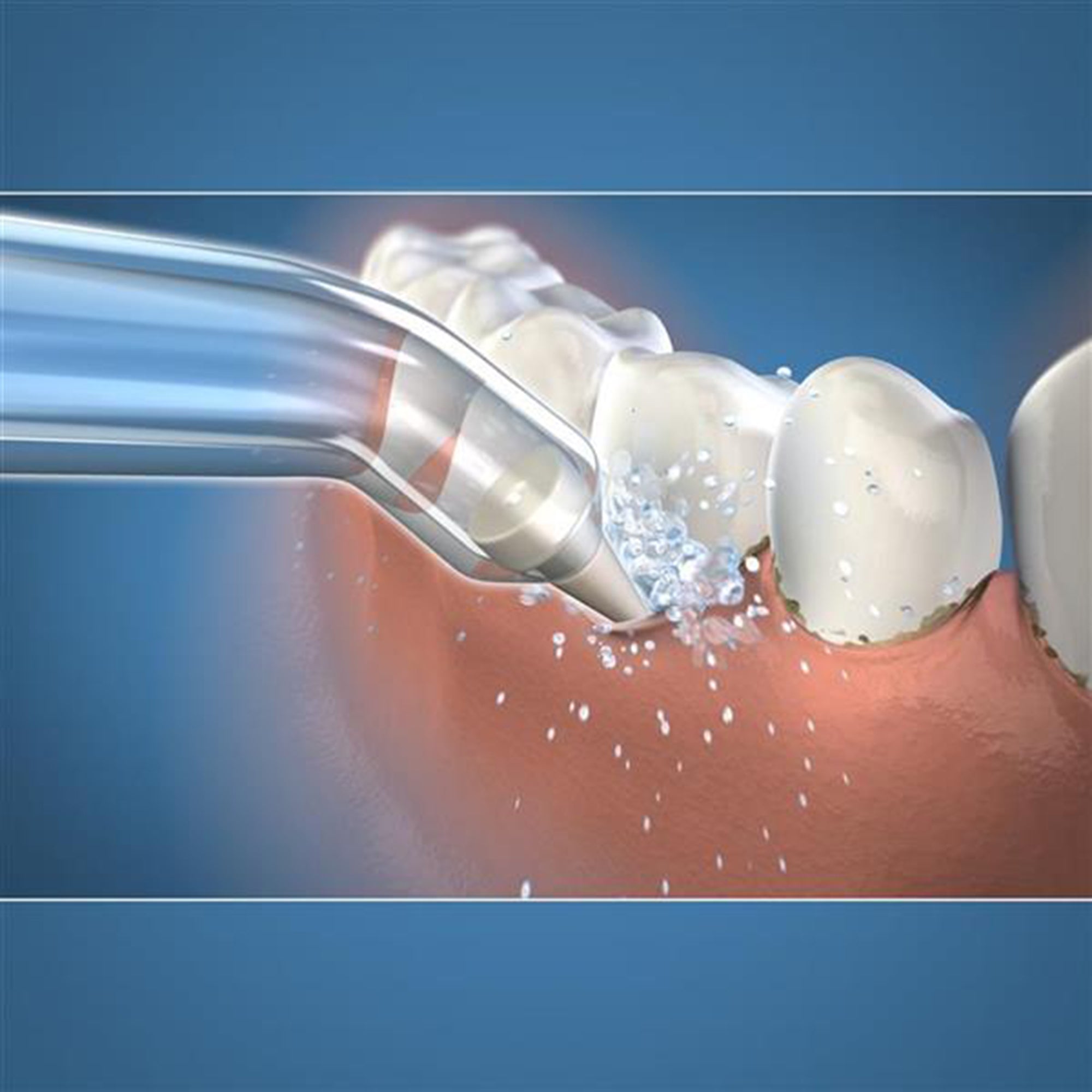 Pik Pocket Water Flosser Tip