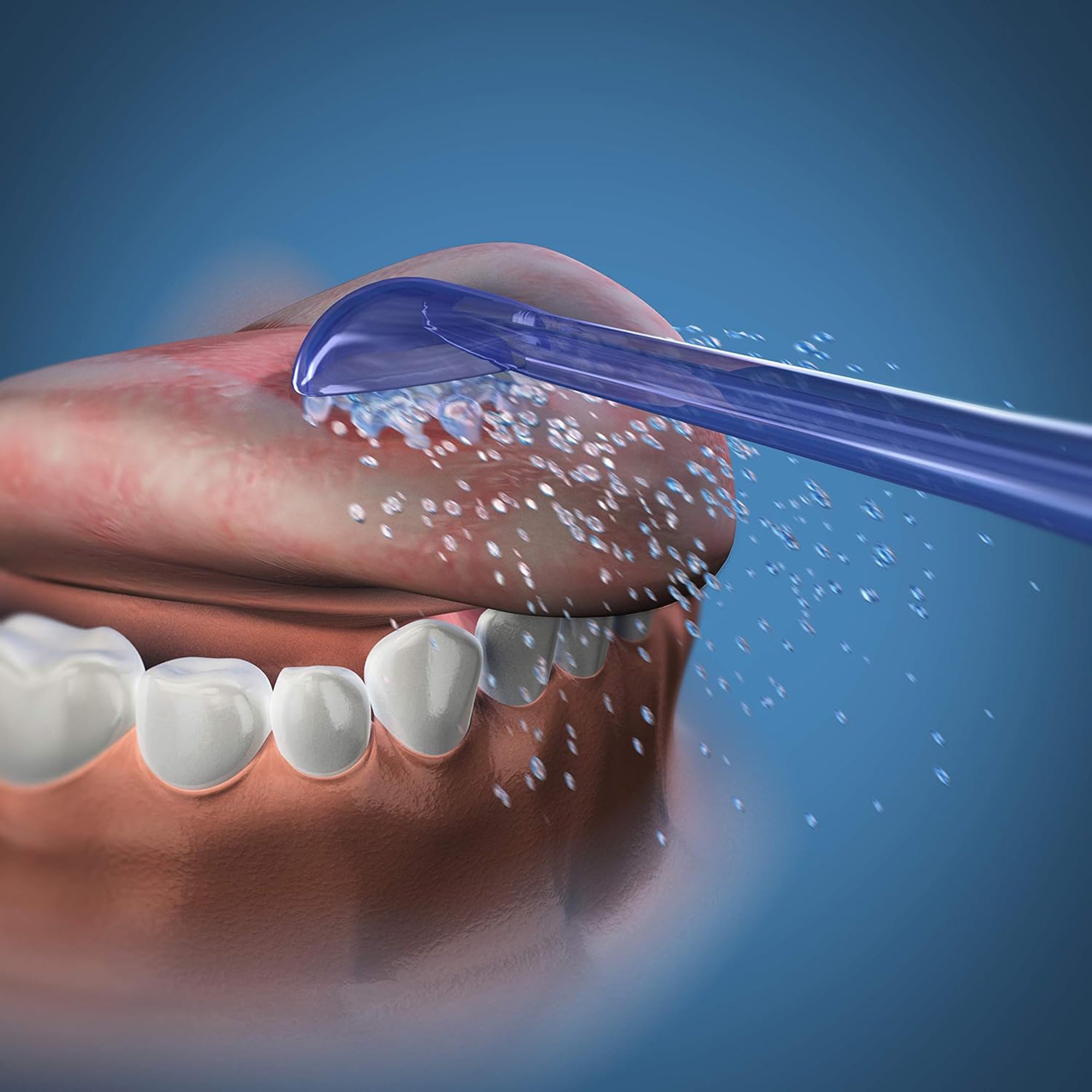 Tongue Cleaner Water Flosser Tip